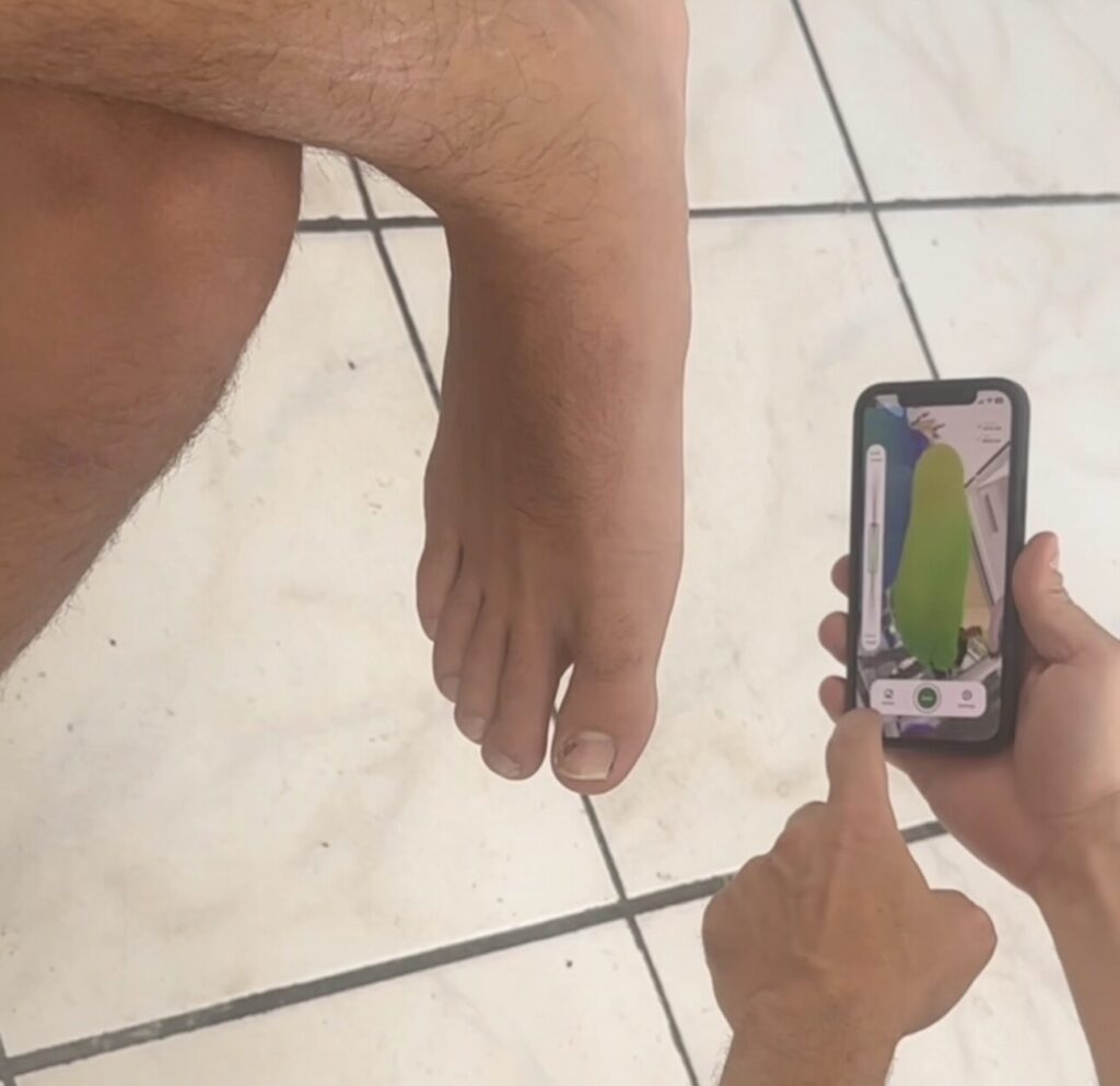 3D σάρωση ποδιού για custom ορθωτικά πέλματα στη MyOrthotics